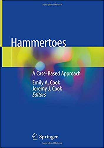 Hammertoes: A Case-Based Approach 1st ed. 2019 Edition PDF