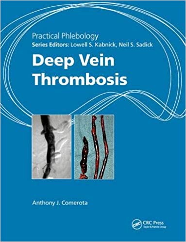 Practical Phlebology: Deep Vein Thrombosis 1st Edition PDF