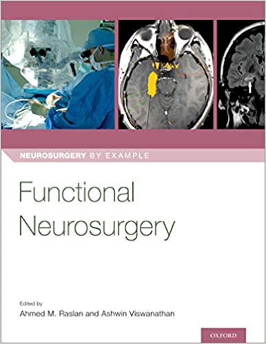 Functional Neurosurgery (Neurosurgery by Example) 1st Edition PDF