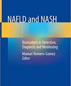 NAFLD and NASH: Biomarkers in Detection, Diagnosis and Monitoring 1st ed. 2020 Edition PDF