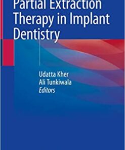 Partial Extraction Therapy in Implant Dentistry 1st ed. 2020 Edition PDF
