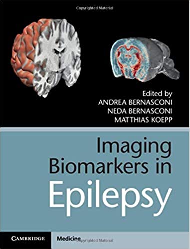 Imaging Biomarkers in Epilepsy 1st Edition PDF