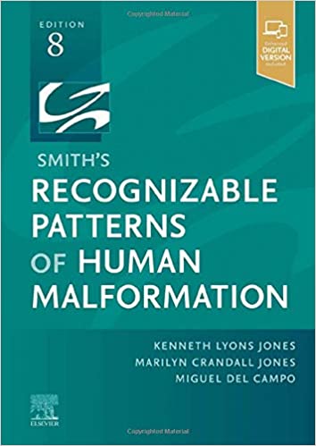 Smith's Recognizable Patterns of Human Malformation 8th Edition PDF
