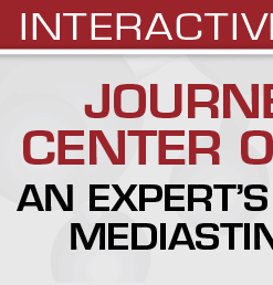 USCAP Journey to the Center of the Chest: An Expert’s Perspective On Mediastinal Pathology 2021 (CME VIDEOS)