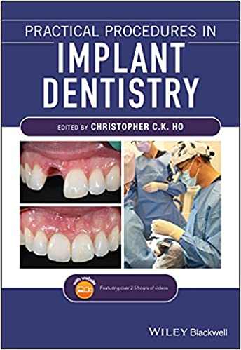 Practical Procedures in Implant Dentistry 1st Edition PDF