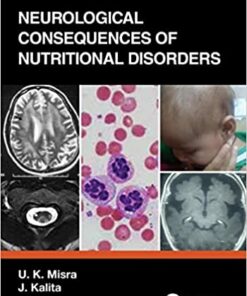 Neurological Consequences of Nutritional Disorders 1st Edition PDF
