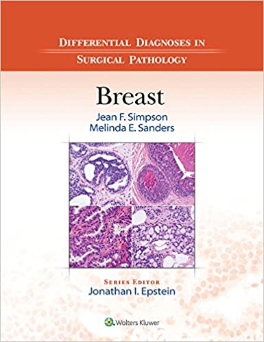 Differential Diagnoses in Surgical Pathology: Breast 1st Edition PDF