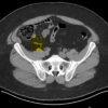1637742419 1780042022 mrionline imaging mastery series appendix 2021.jpg