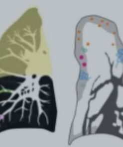 Imaging Mastery Series: Consolidation and Ground Glass 2021
