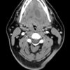 1638867036 1810062838 imaging mastery series pathology of the oral cavity and oropharynx 2020.jpg