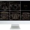 1638953509 271373232 pearls and pitfalls in prostate and pelvic imaging 2021.jpg