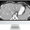 1639033513 623551453 sar disease focused panels cancer imaging and reporting guidelines 2021.jpg