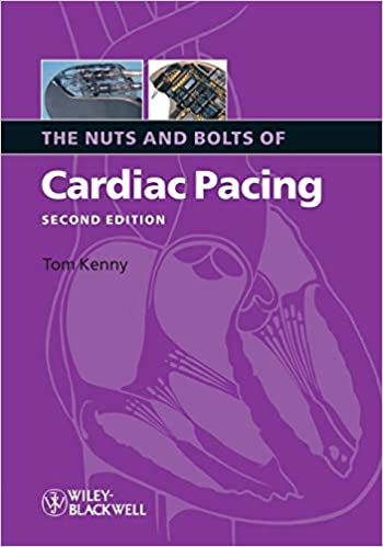 The Nuts and Bolts of Cardiac Pacing, 2nd Edition (EPUB)