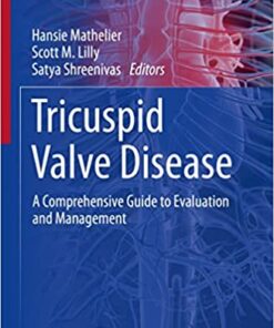 Tricuspid Valve Disease: A Comprehensive Guide to Evaluation and Management (Contemporary Cardiology) (Original PDF from Publisher)