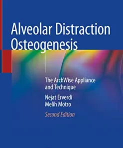 Alveolar Distraction Osteogenesis: The ArchWise Appliance and Technique, 2nd Edition (Original PDF from Publisher)