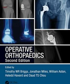 Operative Orthopaedics, 2ed (Original PDF from Publisher)
