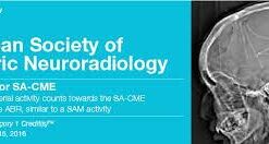 2016 American Society of Pediatric Neuroradiology - A Video CME Teaching Activity