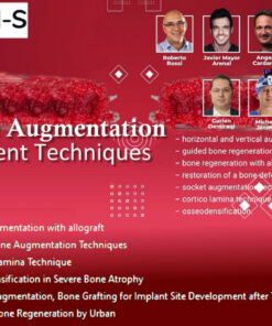 Bone Augmentation, Current Techniques