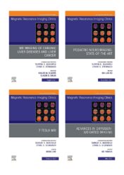 Magnetic resonance imaging clinics of north america 2021 full archives true pdf