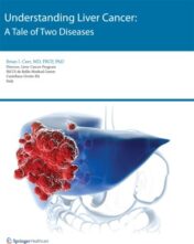 Understanding Liver Cancer(ORIGINAL PDF)