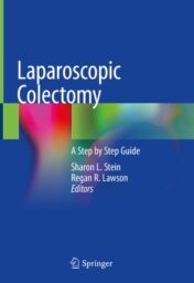 Laparoscopic Colectomy A Step by Step Guide 2020 Original pdf