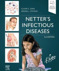 Netter’s Infectious Diseases (True PDF)