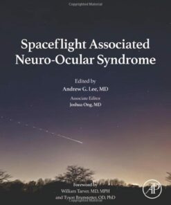 Spaceflight Associated Neuro-Ocular Syndrome (Original PDF from Publisher)