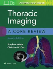 Thoracic Imaging: A Core Review, 2nd edition (ePub+Converted PDF)