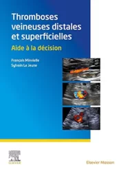 Thromboses veineuses distales et superficielles: Aide à la décision (French Edition) 2021 Original PDF