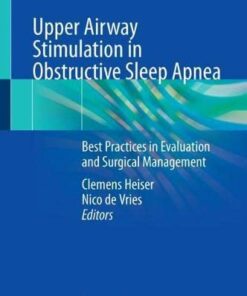 Upper Airway Stimulation in Obstructive Sleep Apnea: Best Practices in Evaluation and Surgical Management (Original PDF from Publisher)