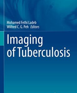 Imaging of Tuberculosis (Medical Radiology) (Original PDF from Publisher)