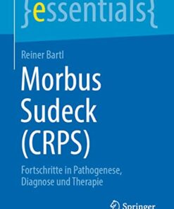 Morbus Sudeck (CRPS): Fortschritte in Pathogenese, Diagnose und Therapie (essentials) (German Edition) (Original PDF from Publisher)