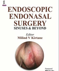 Functional Endoscopic Sinus Surgery (Endoscopic Endonasal Surgery Sinuses & Beyond: Sinuses and Beyond) (Original PDF from Publisher)