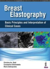 Breast Elastography: Basic Principles and Interpretation of Clinical Cases (Original PDF)