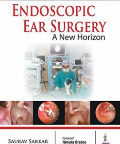 Endoscopic Ear Surgery a New Horizon (Original PDF from Publisher)