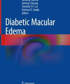 Diabetic Macular Edema (Original PDF from Publisher)