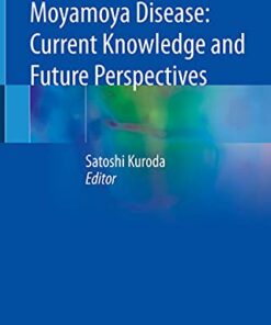 Moyamoya Disease: Current Knowledge and Future Perspectives (Original PDF from Publisher)