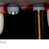 A to z in Implant Dentistry.jpg