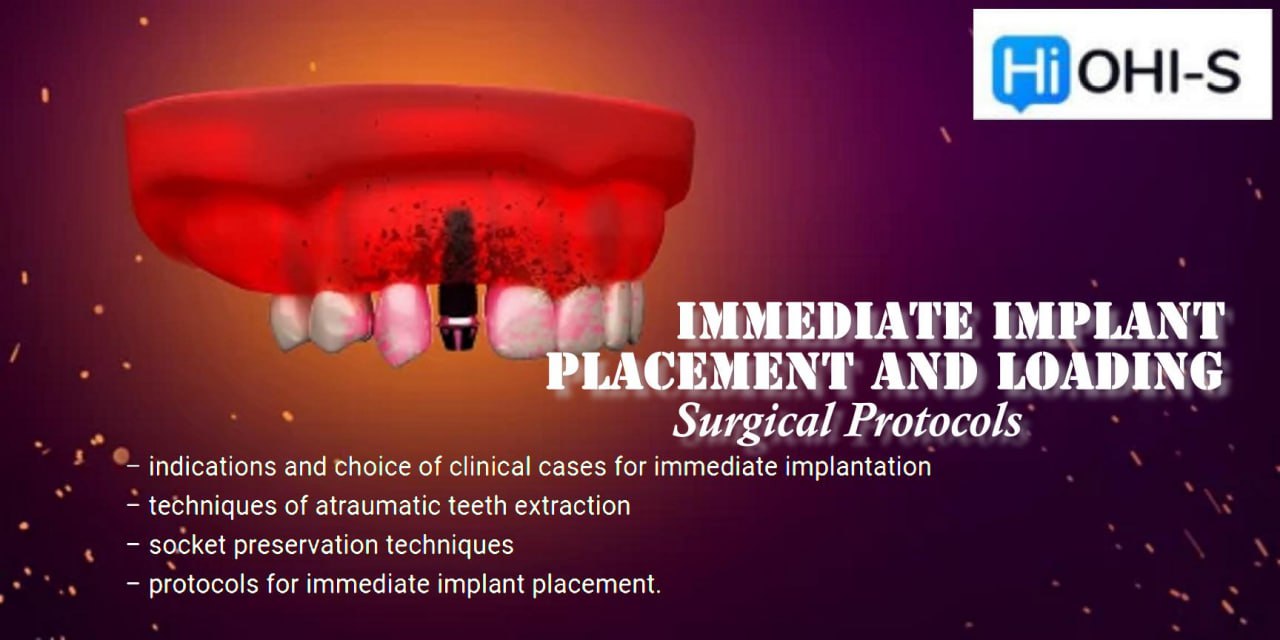 OHI-S Immediate Implant Placement and Loading Surgical Protocols