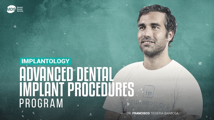 Advanced Dental Implant Procedures -Dr Francisco Teixeria Barbosa-