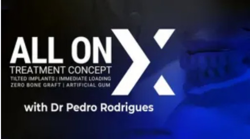 All On X Treatment Concept (Video Course)
