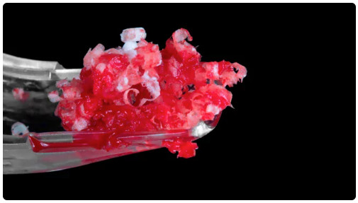 OHI-S Bone Augmentation 2.0, New Techniques and Protocols