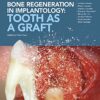 Bone regeneration in implantology.jpg