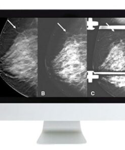 Breast Imaging: Screening and Diagnosis