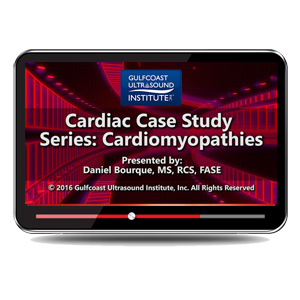 Cardiac Case Study Series: Cardiomyopathies