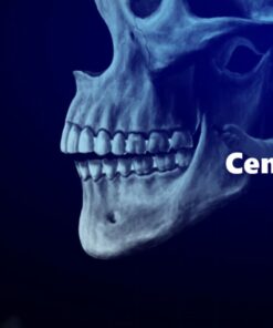 Centric Relation Total War- Master Level Webinars - Lukasz Lassmann (Master of TMD and FMR)