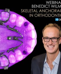 Challenging orthodontic cases: the use of skeletal anchorage