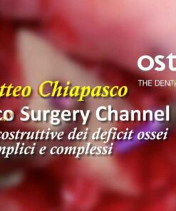 Chiapasco Surgery Channel - Matteo Chiapasco Tecniche ricostruttive dei deficit ossei semplici e complessi