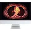 Clinical Nuclear Medicine Review.jpg