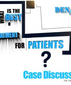 DENALL What is the Best Treatment for Patients? Case Discussion Korean with English Narration